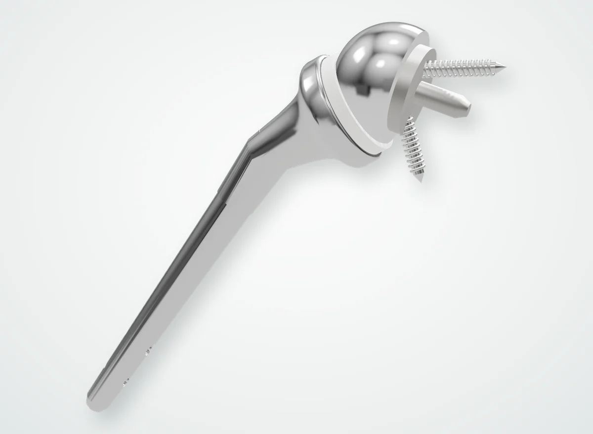 3D illustration of a reverse shoulder prosthesis: humeral stem, polyethylene insert, glenosphere and baseplate with its fixation screws